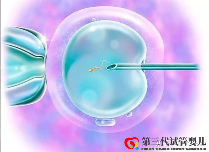 通俗易懂的一、二、三代試管嬰兒解說,及三代試管能...(圖3)