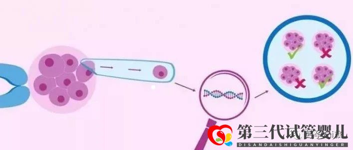 通俗易懂的一、二、三代試管嬰兒解說,及三代試管能...(圖7)