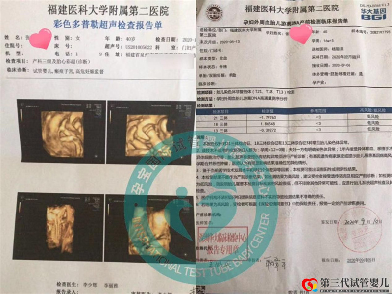 40歲高齡渴求兒女雙全三代試管圓“湊好“之夢(mèng)成功案例(圖1) 40歲高齡渴求兒女雙全三代試管圓“湊好“之夢(mèng)成功案例(圖1)