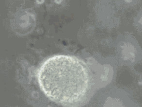 精子碎片率高可以做三代試管嬰兒?jiǎn)幔?圖1) 精子碎片率高可以做三代試管嬰兒?jiǎn)幔?圖1)