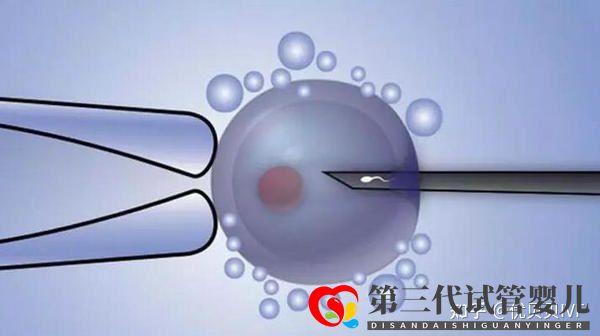 國內(nèi)的三代試管醫(yī)院都有哪些第一梯隊了解下(圖3) 國內(nèi)的三代試管醫(yī)院都有哪些第一梯隊了解下(圖3)