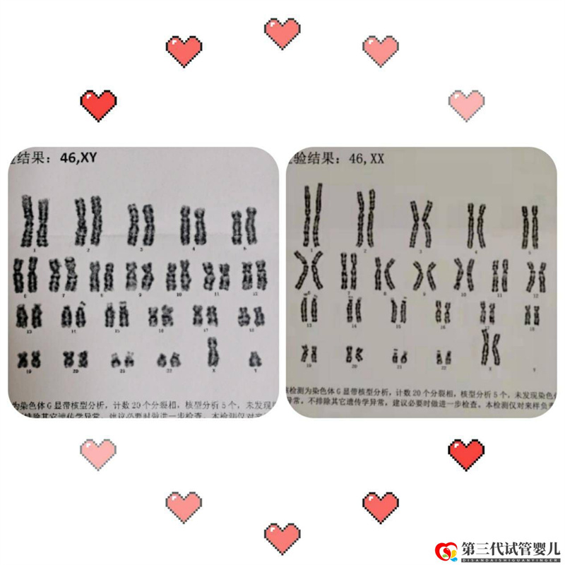 為什么父母染色體正常，胚胎染色體卻有問題？(圖1)