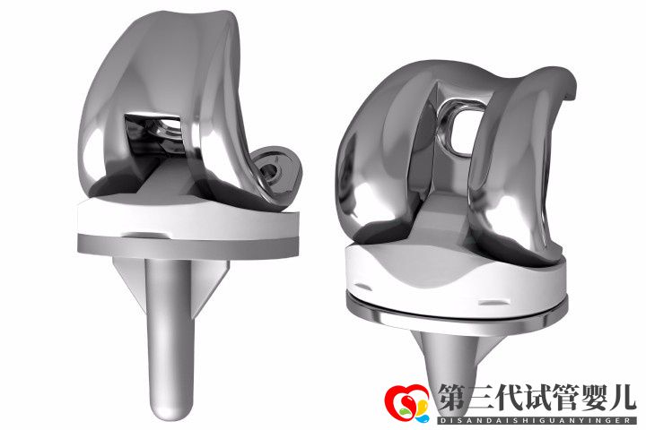 人工膝關(guān)節(jié)置換手術(shù)成功率大嗎？膝關(guān)節(jié)置換手術(shù)成功率有多高？(圖1)