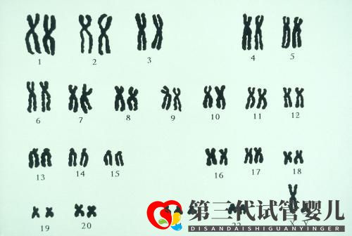 夫妻染色體正常，試管胚胎染色體異常的三個(gè)原因你都知道嗎？(圖1)