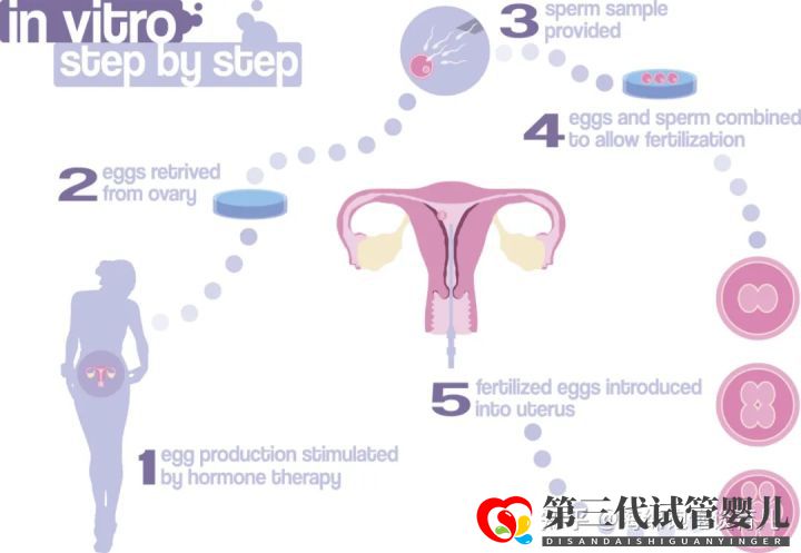 試管嬰兒1代、2代、3代、4代哪個(gè)最好真實(shí)操作過...(圖4)