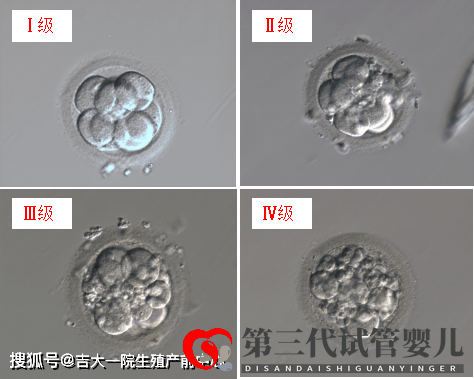 胚胎能看出來男女嗎？(圖1)