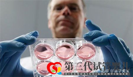 掌控這三點(diǎn),高齡女性做試管嬰兒成功率將達(dá)100%(圖4) 掌控這三點(diǎn),高齡女性做試管嬰兒成功率將達(dá)100%(圖4)