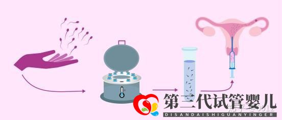 人授還是試管應(yīng)該怎么選(圖2) 人授還是試管應(yīng)該怎么選(圖2)