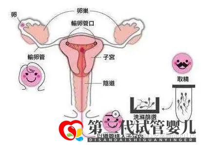 人工授精跟試管嬰兒的區(qū)別(圖9) 人工授精跟試管嬰兒的區(qū)別(圖9)