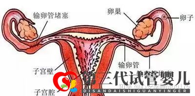 人工授精跟試管嬰兒的區(qū)別(圖5) 人工授精跟試管嬰兒的區(qū)別(圖5)