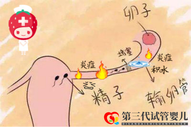 報喜萬家！輸卵管積水的她放棄做試管，卻憑一劑中藥喜獲“好孕”(圖1)