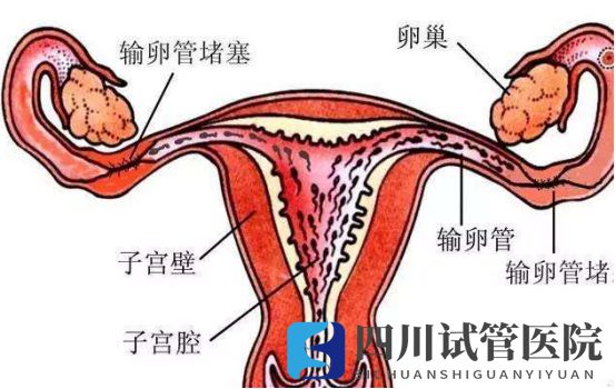 成都兩側(cè)輸卵管堵塞想要孩子，聽說試管嬰兒是最好的選擇(圖1)
