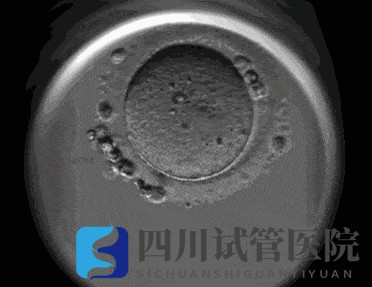 成都試管嬰兒醫(yī)院引進“時差培養(yǎng)箱”，助力篩選更具發(fā)育潛力的胚胎(圖2)