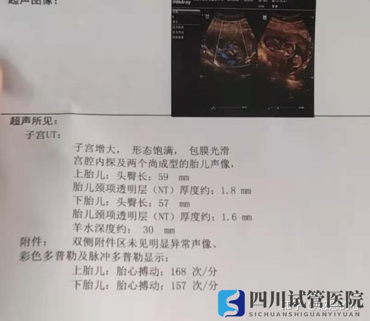 我在成都做三代試管的經(jīng)歷(標(biāo)圖接好孕)(圖5) 我在成都做三代試管的經(jīng)歷(標(biāo)圖接好孕)(圖5)
