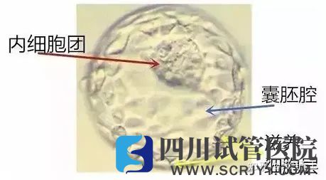 試管嬰兒選取移植胚胎的標準是什么(圖4) 試管嬰兒選取移植胚胎的標準是什么(圖4)