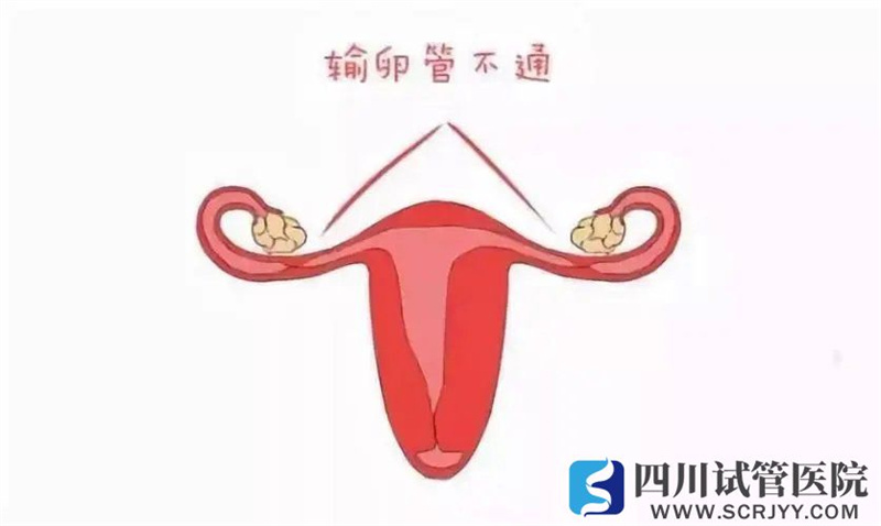 輸卵管的這兩項(xiàng)功能對(duì)懷孕至關(guān)重要，怎么知道它好不好？(圖1)