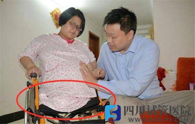 “無腿”媽媽試管生下雙胞胎，如今5年過去，一家人現(xiàn)狀如何？(圖1)