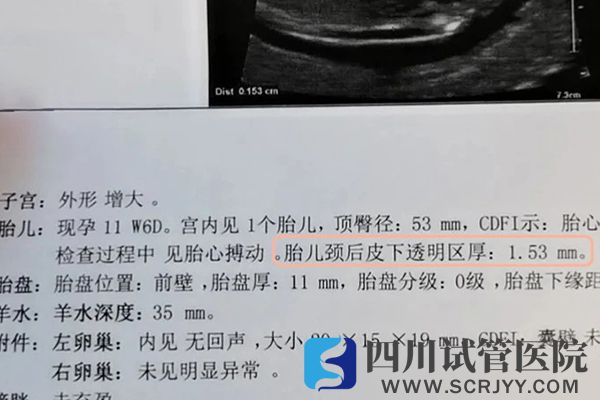胎兒頸后透明帶增厚表示存在致病風(fēng)險