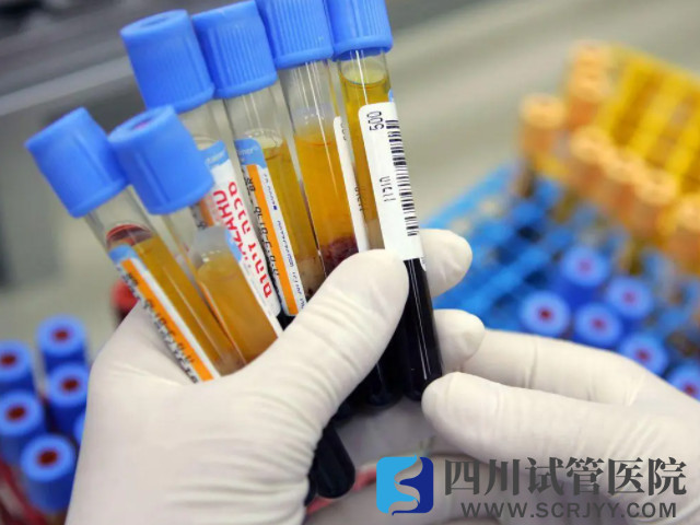 備孕需要要做性激素六項(xiàng)檢查