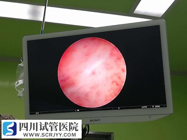 內(nèi)膜診刮會損傷子宮內(nèi)膜