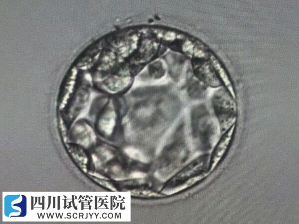 養(yǎng)囊后移植成功率更高